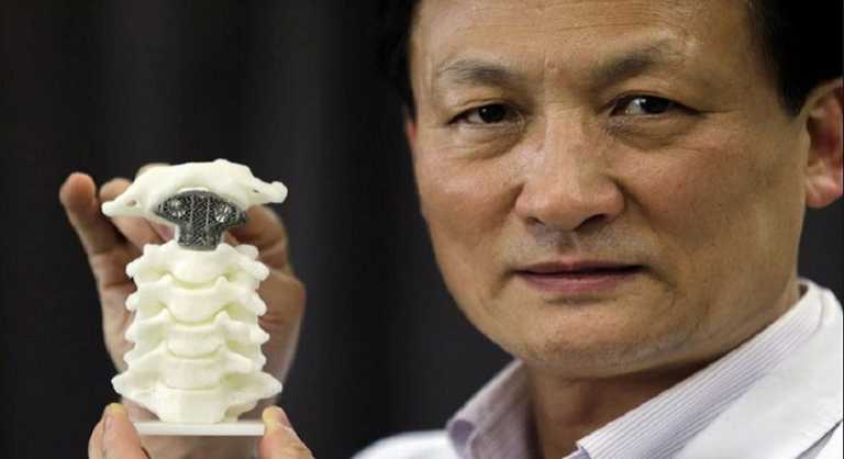 World’s First 3D-Printed Vertebra Implanted in China