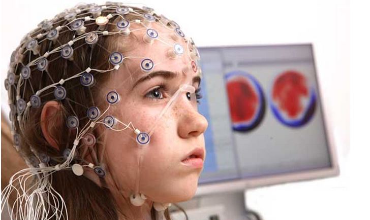 brain-Electroencephalography-Wisconsin-Madison