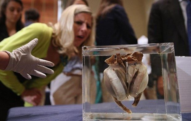 _World's first artificial heart on display at Smithsonian Institute, Washington DC