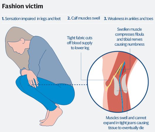 Are skinny jeans making you FAT? As study warns they can cut off the blood  supply to the legs, one expert warns they're also fuelling the obesity  crisis | Daily Mail Online