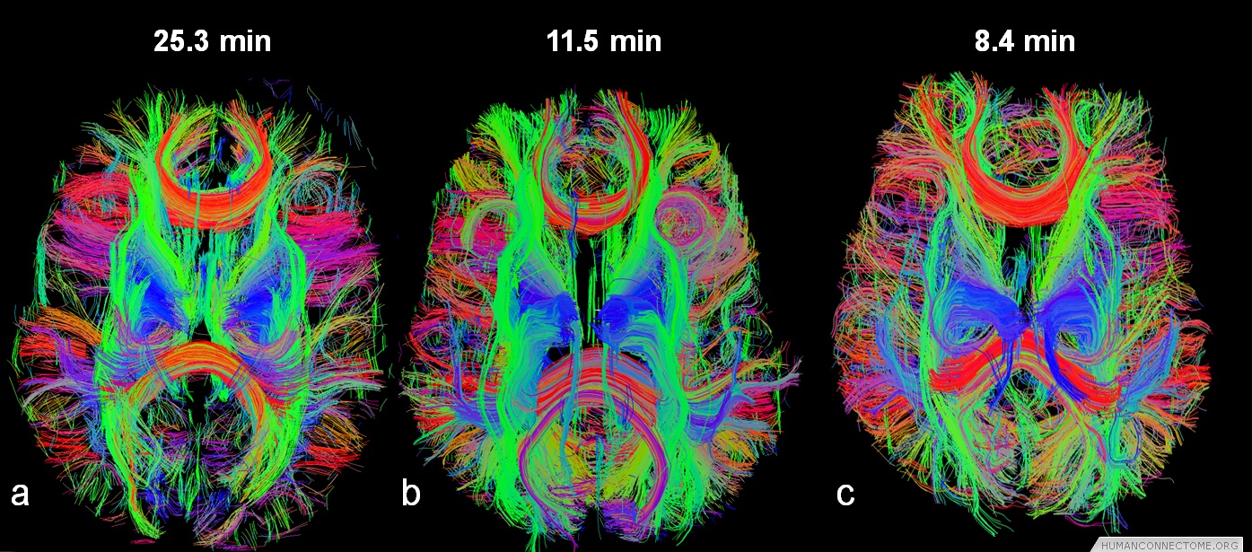 successful-people-have-better-brains-shows-study