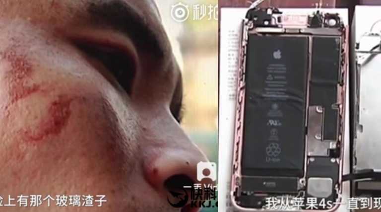 Apple iPhone 7 Explodes On Man’s Face While Recording Video