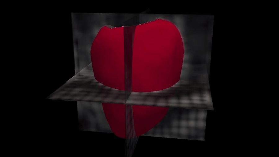 3D heart image failure prediction