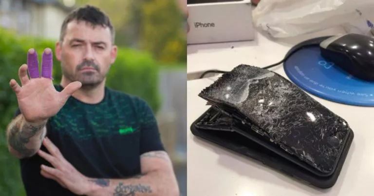 iPhone Explodes In Man’s Hand, Causes Heavy Bleeding — “I Could Have Lost My Hand”