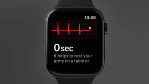 Apple Watch Series ECG monitor