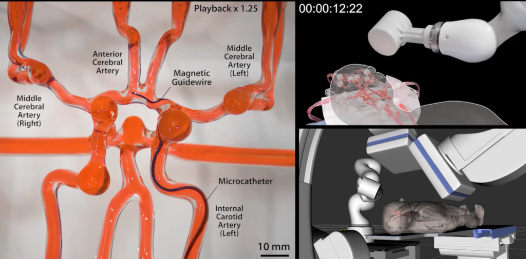 MIT robot surgeon