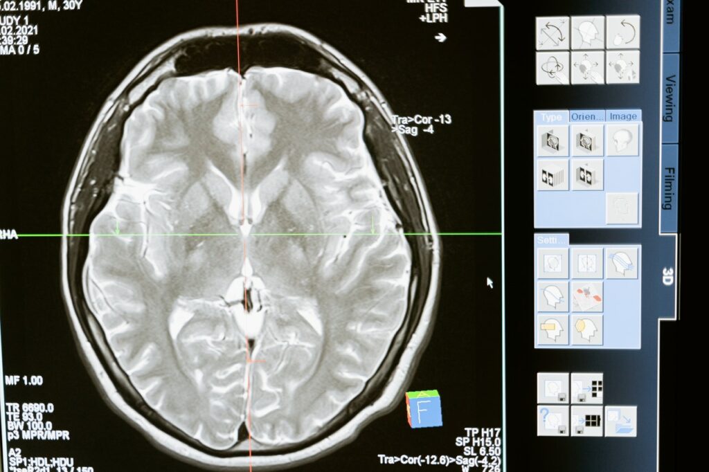 controlling brain circuits